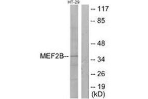 Western blot analysis of extracts from HT-29 cells, using MEF2B Antibody. (MEF2B antibody  (AA 51-100))