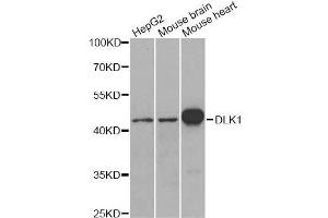 Western blot analysis of extracts of various cell lines, using DLK1 antibody. (DLK1 antibody  (AA 83-383))