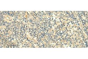 Immunohistochemistry of paraffin-embedded Human tonsil tissue using TMEM9 Polyclonal Antibody at dilution of 1:50(x200) (TMEM9 antibody)