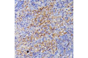 Immunohistochemistry of paraffin-embedded rat lymph node using SN antibody (ABIN7270670) at dilution of 1:100 (40x lens). (SNAP23 antibody  (AA 1-211))
