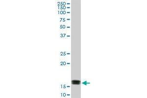 ACP1 monoclonal antibody (M01), clone 4B10. (ACP1 antibody  (AA 1-158))