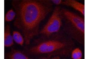 Immunofluorescence staining of methanol-fixed HeLa cells using SYT1 (phospho S309) polyclonal antibody . (SYT1 antibody  (pSer309))