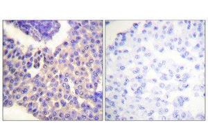 Immunohistochemistry (IHC) image for anti-Arrestin, beta 1 (ARRB1) (pSer412) antibody (ABIN1847266) (beta Arrestin 1 antibody  (pSer412))