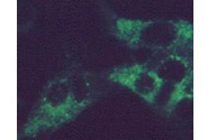 Immunofluorescence using MAb-G-1 on RSV infected HEp-2 cells (Respiratory Syncytial Virus Long Strain (RSV Long) antibody)