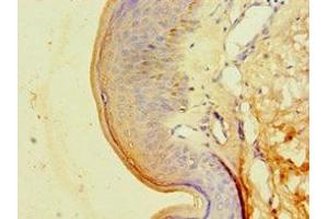 Immunohistochemistry of paraffin-embedded human skin tissue using ABIN7146714 at dilution of 1:100 (CA14 antibody  (AA 16-290))