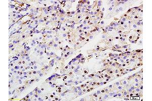 Formalin-fixed and paraffin embedded rat pancreas labeled with Anti-ASF1A Polyclonal Antibody, Unconjugated (ABIN703961) at 1:200 followed by conjugation to the secondary antibody and DAB staining (ASF1A antibody  (AA 101-204))