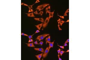 Immunofluorescence analysis of NIH-3T3 cells using UQCRFS1 Rabbit mAb (ABIN7271127) at dilution of 1:100 (40x lens). (UQCRFS1 antibody)