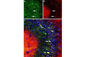 Multiplex staining of DPP6 and KV4. (DPP6 antibody  (C-Term, Extracellular))