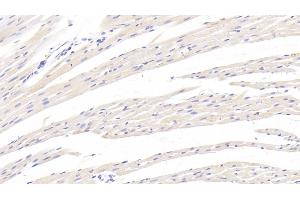 Detection of TGFb1 in Rat Cardiac Muscle Tissue using Monoclonal Antibody to Transforming Growth Factor Beta 1 (TGFb1) (TGFB1 antibody  (AA 279-390))