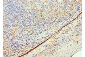 Immunohistochemistry of paraffin-embedded human tonsil tissue using ABIN7172113 at dilution of 1:100 (TK1 antibody  (AA 1-234))