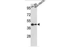 Western blot analysis of GSDMB Antibody (Center) in HL-60, MDA-MB435 cell line lysates (35ug/lane).