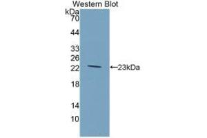 Western blot analysis of recombinant Rat GKRP.
