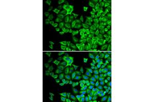 Immunofluorescence analysis of A549 cells using HCK antibody. (HCK antibody)