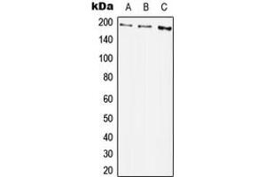 Western blot analysis of PDGFR beta (pY1009) expression in A549 (A), Raw264. (PDGFRB antibody  (C-Term, pTyr1009))