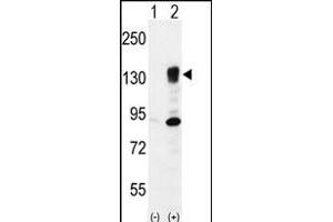 Western blot analysis of ITGA5 (arrow) using rabbit polyclonal ITGA5 Antibody (Center) (ABIN656138 and ABIN2845477).