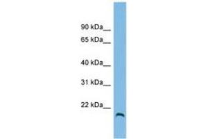 Image no. 1 for anti-Hemochromatosis Type 2 (Juvenile) (HFE2) (AA 35-84) antibody (ABIN6745034) (HFE2 antibody  (AA 35-84))