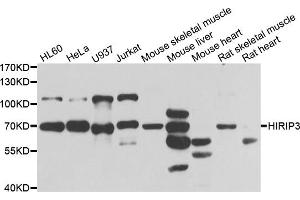 Western blot analysis of extracts of various cell lines, using HIRIP3 antibody. (HIRIP3 antibody)