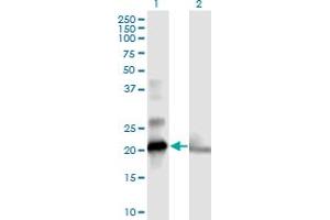 Western Blot analysis of COMMD1 expression in transfected 293T cell line by COMMD1 MaxPab polyclonal antibody.
