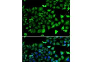 Immunofluorescence analysis of A-549 cells using NFYB Polyclonal Antibody (NFYB antibody)