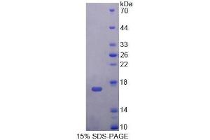 SDS-PAGE (SDS) image for Transition Protein 2 (During Histone To Protamine Replacement) (TNP2) (AA 1-117) protein (His tag) (ABIN4989546)