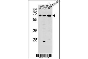 Western blot analysis in Jurkat,ZR-75-1,MDA-MB231 cell line lysates (35ug/lane). (ZSCAN2 antibody  (N-Term))