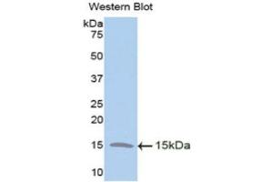 Western Blotting (WB) image for anti-Trefoil Factor 2 (TFF2) (AA 27-128) antibody (ABIN1173507)
