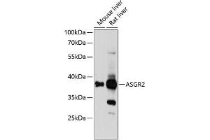 Western blot analysis of extracts of various cell lines, using  Antibody (ABIN6127455, ABIN6137182, ABIN6137185 and ABIN6218131) at 1:1000 dilution.
