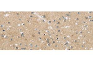 Immunohistochemistry of paraffin-embedded Human brain using MPP6 Polyclonal Antibody at dilution of 1/25 (MPP6 antibody)