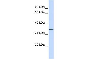 WB Suggested Anti-GNPDA1 Antibody Titration:  0. (GNPDA1 antibody  (C-Term))