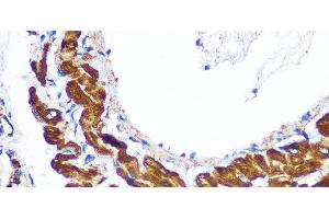 Immunohistochemistry of paraffin-embedded Rat lung using YTHDF2 Polyclonal Antibody at dilution of 1:100 (40x lens).