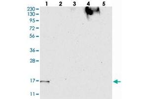 Western blot analysis of Lane 1: RT-4, Lane 2: U-251 MG, Lane 3: Human Plasma, Lane 4: Liver, Lane 5: Tonsil with FAM162A polyclonal antibody  at 1:250-1:500 dilution. (F162A antibody)