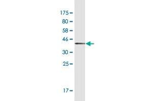 Western Blot detection against Immunogen (37. (HTRA3 antibody  (AA 344-453))