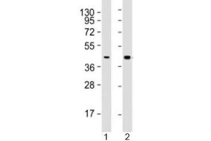 Western blot testing of human 1) HepG2 (liver carcinoma line) and 2) liver lysate with AGXT antibody at 1:2000.