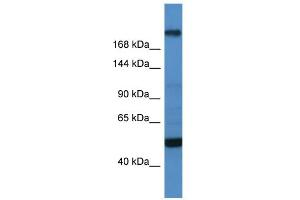 WB Suggested Anti-TCF20 Antibody Titration:  0. (TCF20 antibody  (C-Term))