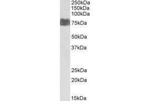 AP20114PU-N LARGE antibody staining of Human Kidney lysate at 1 µg/ml (RIPA buffer, 35 µg total protein per lane).