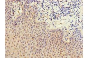 Immunohistochemistry of paraffin-embedded human tonsil tissue using ABIN7158638 at dilution of 1:100 (LY75/DEC-205 antibody  (AA 440-680))