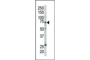 Western blot analysis of anti-RAF1 Pab (ABIN392261 and ABIN2841943) in Jurkat cell lysate. (RAF1 antibody  (N-Term))