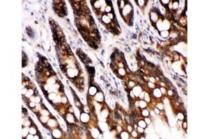 IHC-P: Caspase-6 antibody testing of rat intestine tissue (Caspase 6 antibody  (AA 7-27))