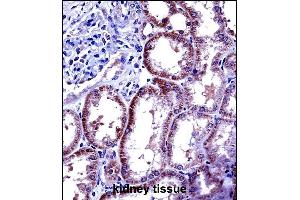 IL6 Antibody (Center) ((ABIN656406 and ABIN2845700))immunohistochemistry analysis in formalin fixed and paraffin embedded human kidney tissue followed by peroxidase conjugation of the secondary antibody and DAB staining. (IL-6 antibody  (AA 27-55))