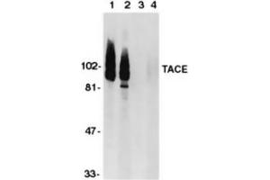 Western blot analysis of CD156b (TACE) in HeLa (1,3) and Jurkat (2,4) whole cell lysate in the absence (1,2) or presence (3,4) of blocking peptide with ABIN121589. (ADAM17 antibody  (AA 807-823))