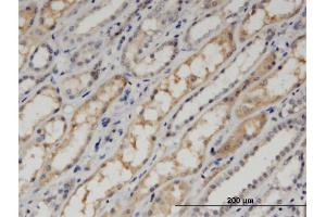 Immunoperoxidase of monoclonal antibody to PDLIM1 on formalin-fixed paraffin-embedded human kidney. (PDLIM1 antibody  (AA 123-232))