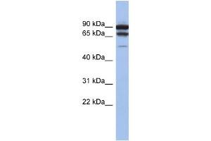 WB Suggested Anti-TP73 Antibody Titration:  0. (Tumor Protein p73 antibody  (Middle Region))