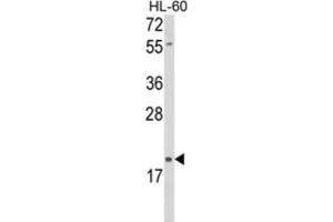 Western Blotting (WB) image for anti-delta-Like 2 Homolog (DLK2) antibody (ABIN5024466) (DLK2 antibody)