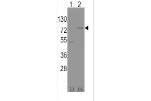 Western blot analysis of Nrf2(Nfe2l2)(arrow) using rabbit polyclonal Nrf2(Nfe2l2) Antibody (N-term) (ABIN391424 and ABIN2841417). (NRF2 antibody  (N-Term))