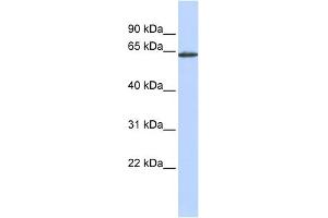 WB Suggested Anti-ANTXR1 Antibody Titration:  0. (ANTXR1 antibody  (Middle Region))