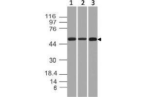 Image no. 1 for anti-Cytokeratin-2P (KRT76) (AA 145-362) antibody (ABIN5027491) (Cytokeratin 2 antibody  (AA 145-362))