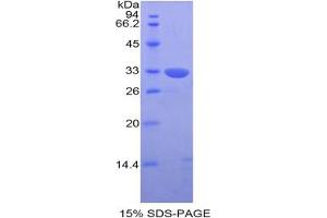 SDS-PAGE analysis of Human KIR2DS4 Protein. (KIR2DS4 Protein)