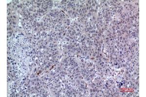 Immunohistochemistry (IHC) image for anti-Leukocyte Immunoglobulin-Like Receptor, Subfamily A (With TM Domain), Member 2 (LILRA2) (Internal Region) antibody (ABIN6281107)