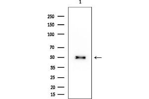 Western blot analysis of lysates from HUVEC cells, using ILKAP Mouse Monoclonal Antibody at 1/1000 dilution.