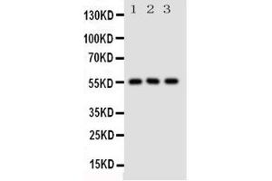 Western Blotting (WB) image for anti-Solute Carrier Family 2 (Facilitated Glucose/fructose Transporter), Member 5 (SLC2A5) (AA 232-251), (Middle Region) antibody (ABIN3044131)